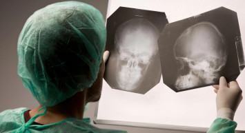 Afazi hastalığı nedir, belirtileri nelerdir? Bruce Willis'e oyunculuğu bıraktıran afazi hastalığı hakkında bilinmesi gerekenler