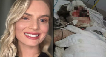 Ağrı kesici yüzünden komalık oldu: Yakınları onu tanıyamadı