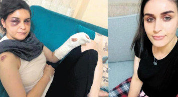 Boşanmak İsteyen Eşine Ailece İşkence Etmişlerdi! Cezaları Belli Oldu