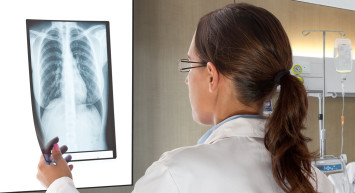 Akciğer Kanseri Neden Olur?