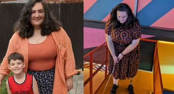 Akıl almaz olay: Bacağının kesilmesine çok sevindi!