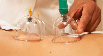 Alternatif Tıp’da ipi göğüsleyen, binbir derde deva olan hacamat nedir, nasıl yapılır?