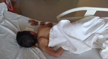 Ankara'da 8 yaşındaki Burak'a uçurtma uçururken köpekler saldırdı: İnsan hayatı bu kadar ucuz olmamalı!