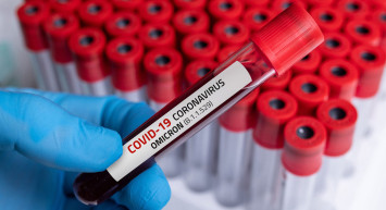 Araştırmalar  Sonuç Verdi: Omicron'da Hastaneye Yatış Oranı Yüzde 75 Daha Az!