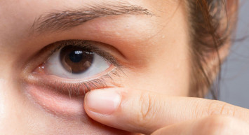 Arpacık Nedir, Nasıl Geçer?