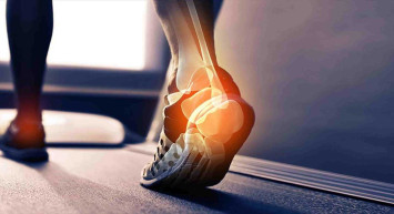 Aşil Tendonu kopması nedir, neresi ve vücutta nerede? Aşil tendonu kopması tedavi süreci ne kadar sürer?