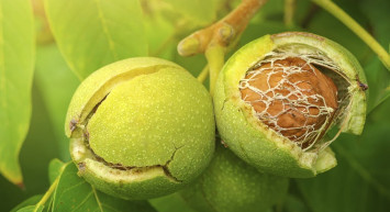 Aşırı Saç Dökülmesinin Nedenleri