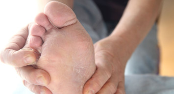 Ayak mantarı nasıl geçer, mantara ne iyi gelir? Ayak mantarını geçirecek 8 doğal çözüm 