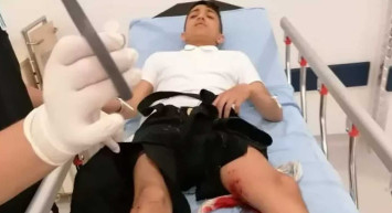 Başıboş köpek saldırısı devam ediyor: Okula giderken köpeklerin saldırısına uğradı