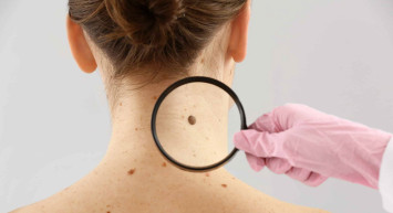 Benleri Koparmanın Zararları Nelerdir?