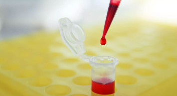 Beyaz kan eksikliği nedir, belirtileri nelerdir, nasıl tedavi edilir?