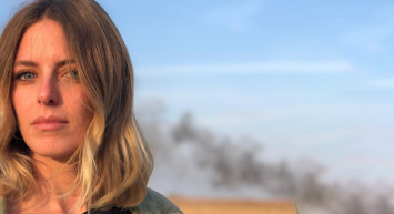 Bige Önal Estetik Hakkında Yorumda Bulundu!