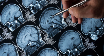 Bilim insanlarından akılalmaz keşif: Kriyojenik olarak dondurulan beyin dokusu zarar görmeden çözüldü