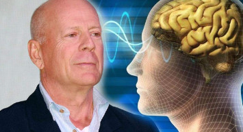 Bruce Willis'in hastalığı afazi nedir? Afazi hastalığı nedir, belirtileri nelerdir?