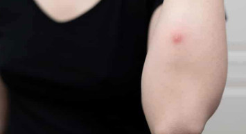 Bu bölgede çıkan çıbana dikkat! Ciddi hastalık habercisi olabilir 