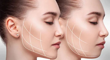 Çekiciliği artırıyor: Özgüven tazelemede çıkık kemik devri!