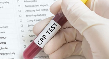 CRP yüksekliği nedir?