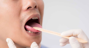 Dil yarası neden oluşur, hangi hastalıkların işareti? Dil yarasına iyi gelen doğal ve bitkisel çözümler