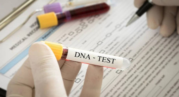 DNA testi için gelmişlerdi: 186 milyon liralık miras aldılar