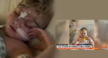 Doktorların yanlış teşhisi yüzünden yıllarca boğazında oyuncak ile yaşadı!