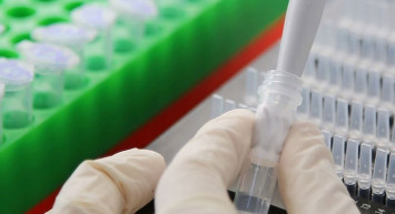 DSÖ, Koronavirüs’ün Kökenine İlişkin Araştırmalarına Tekrar Başlayacak!