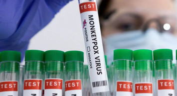 DSÖ’den dünyayı rahatlatan açıklama geldi: ‘Covid-19 gibi bir durum olmayacak’