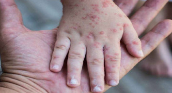 DSÖ’den kritik uyarı: Çok tehlikeli ve öldürücü