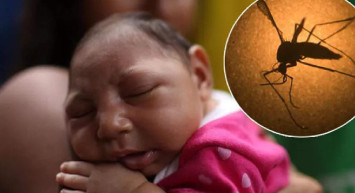Zika virüsü bulaşıcı mı? Zika virüsü hangi ülkelerde görüldü, belirtileri neler? Dünya gündemi yeni tehlike Zika virüsünü konuşuyor!