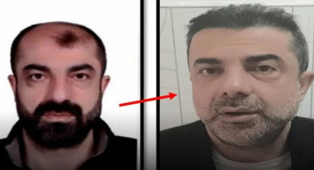 Estetikle Yüzünü Değiştirip Kaçan Firari Zanlı Yakalandı