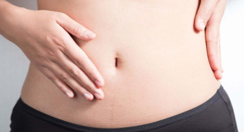 Göbekteki kıllar (tüyler) nasıl gider? Göbek bölgesindeki kıl ve tüylerden kurtulmak için öneriler