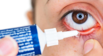 Göz Nezlesi (Konjuktivit) Nedir?