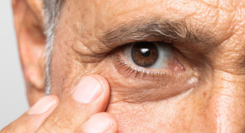 Göz tansiyonu nedir, neden olur, kaç olmalı? Şeker hastalığı göz tansiyonuna yol açıyor