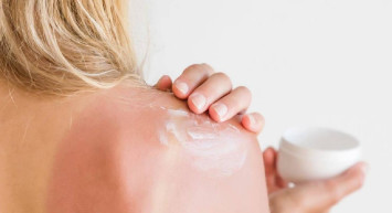 Güneş yanığına ne iyi gelir? Yüzdeki güneş yanığı nasıl geçer? Zararlı güneş ışınlarından korunmanın yolları sizin için araştırdık