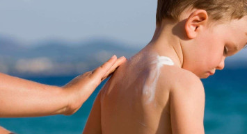 Güneş yanığına yoğurt sürülür mü, zararı var mı? Uzmanlar en etkili güneş yanığı tedavi yöntemlerini açıkladı