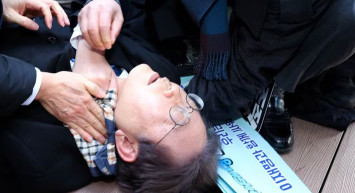 Güney Kore'de skandal olay: Parti lideri boynundan bıçaklandı