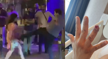 Güvenlik Görevlisinin Parmağını Isırıp Kopardı: 4,5 yıl Hapsi İstendi