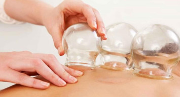 Hacamat nasıl yapılır? Hacamatın vücuda faydaları ve zararları neler? Hacamat yaptırma hangi hastalıklar için iyi gelir?