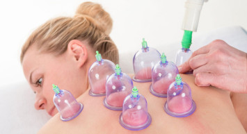 Hacamat Nedir, Faydaları Nelerdir?