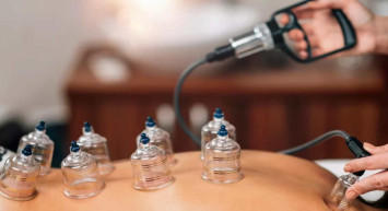 Hacamat nedir, ne demektir? Hacamat olmak ne demek? Hacamat hakkında detaylı bilgiler