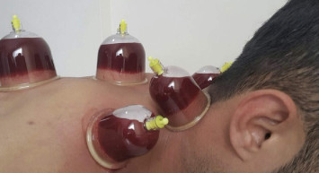 Hacamat yaptırmak orucu bozar mı? Oruçluyken hacamat yaptırılır mı?