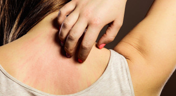 Hangi Tip Kaşıntı Hangi Hastalığın İşareti?