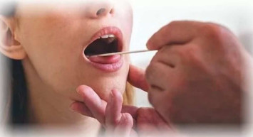 Harita dil hastalığı nedir, nasıl tedavi edilir? Harita dil hastalığında tedavi yöntemleri