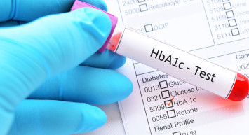HbA1c nedir, normal değeri kaç olmalı, tedavisi nasıl yapılır?  Şeker hastalarının kabusu HbA1c yüksekliği hakkında bilmeniz gerekenler 