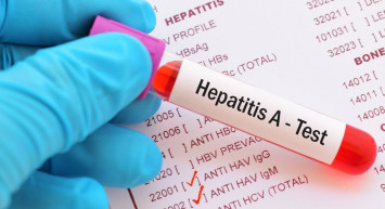 Hepatit A Neden Olur, Nasıl Geçer?