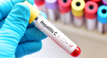 Hepatit C nedir, nasıl bulaşır, aşısı var mı? Hepatit C'den korunma yolları