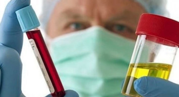 İdrardaki kırmızılık hangi hastalığın habercisi?