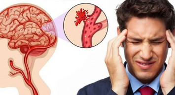 İnsan vücudundaki sinsi hastalık, her an patlamaya hazır bomba: Anevrizma!