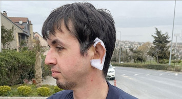 İstanbul'da köpek dehşeti bitmiyor! Genç adama tam 20 dikiş atıldı