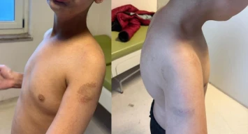 İstanbul'da otizmli çocuklara şiddet!