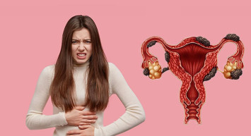 Kadınların rahimlerinde çikolata kisti neden olur? Belirtileri nelerdir?